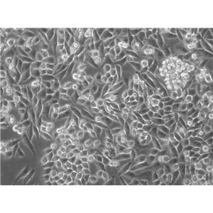 HB611 Adherent人肝母细胞癌细胞系