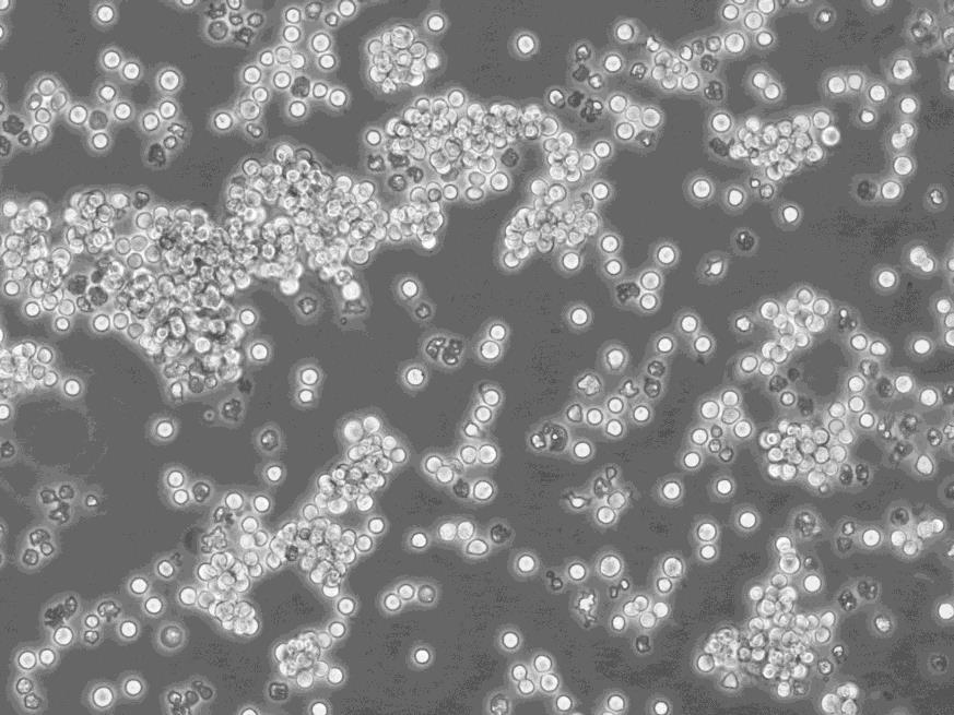 HDLM-2 Suspended人霍奇金淋巴瘤细胞系,HDLM-2 Suspended