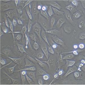 NOR-10 Adherent小鼠骨骼肌成纤维细胞系