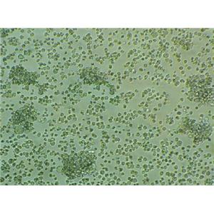 MOLT-4 Suspended人急性淋巴母细胞性白血病细胞系