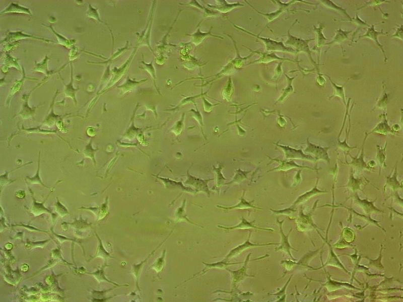 SJSA-1 Thawing人骨肉瘤细胞系,SJSA-1 Thawing