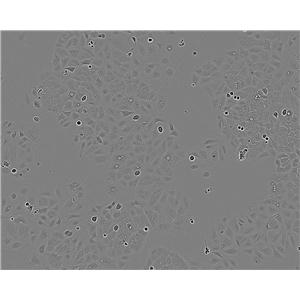 Beta-TC-6 Thawing小鼠胰岛素瘤胰岛β细胞系,Beta-TC-6 Thawing