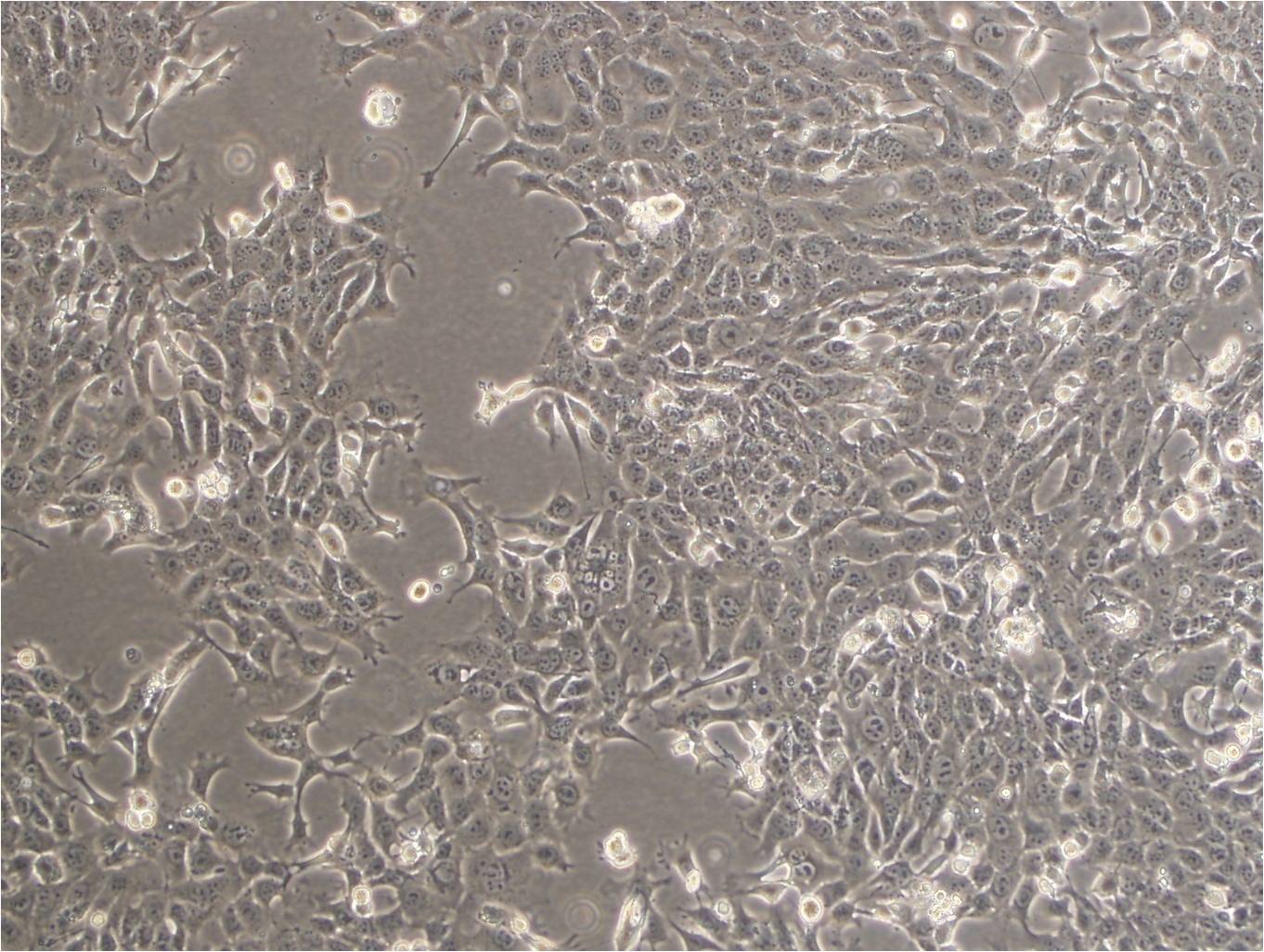PC-10 epithelioid cells人肺鳞癌细胞系,PC-10 epithelioid cells
