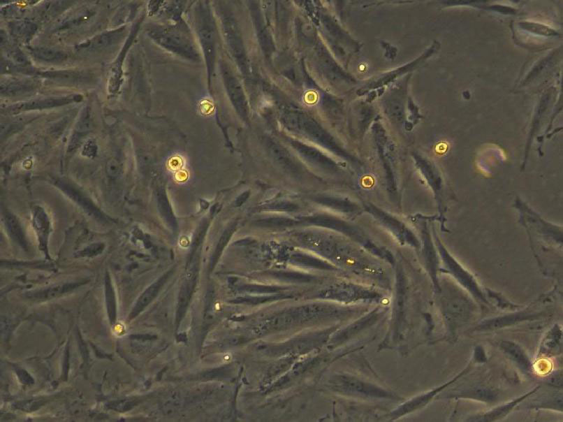 WI-38 fibroblast cells人胚肺成纤维细胞系,WI-38 fibroblast cells