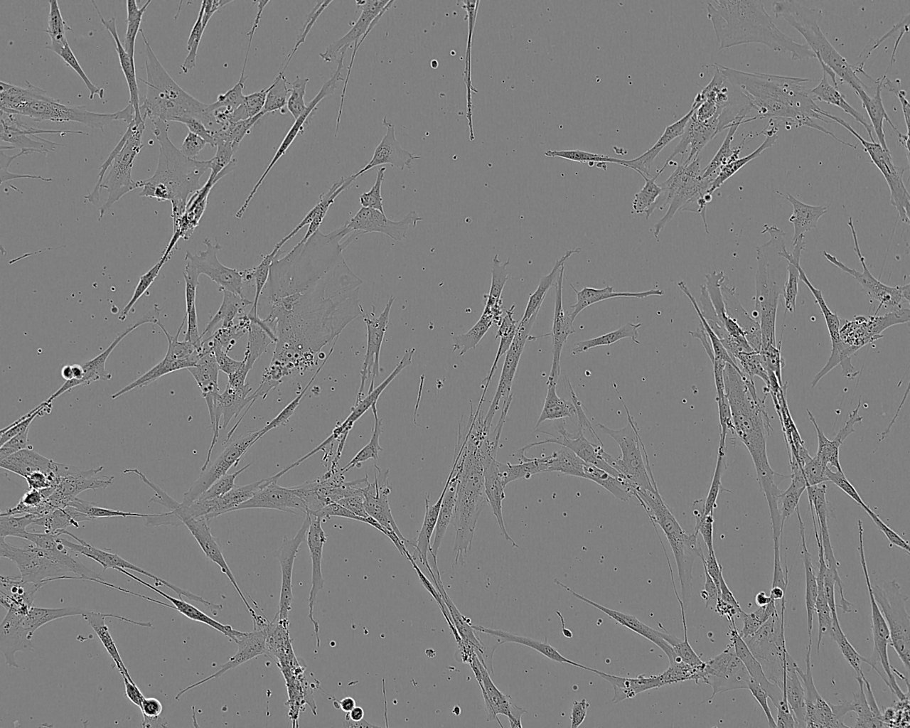 PT-K75 fibroblast cells猪鼻甲黏膜成纤维细胞系,PT-K75 fibroblast cells