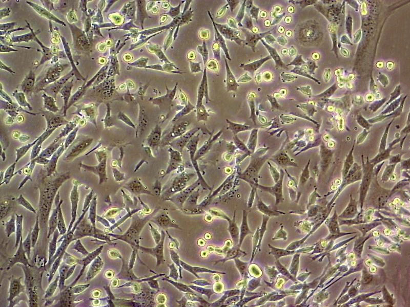 SK-LMS-1 fibroblast cells人阴户平滑肌肉瘤细胞系,SK-LMS-1 fibroblast cells