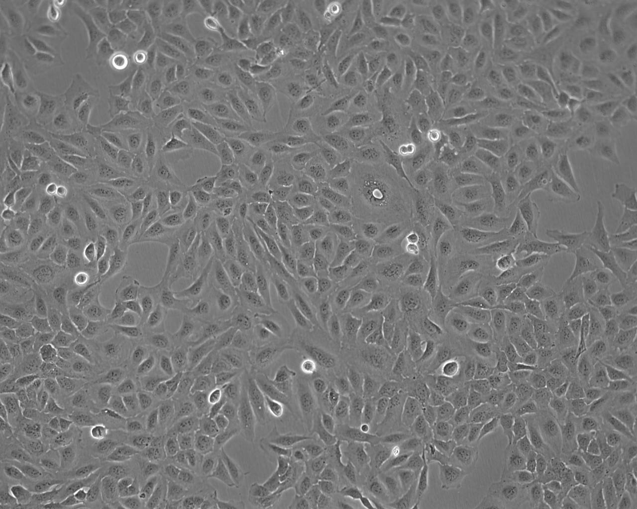 NCI-H596 Thawing人肺腺鳞癌细胞系,NCI-H596 Thawing