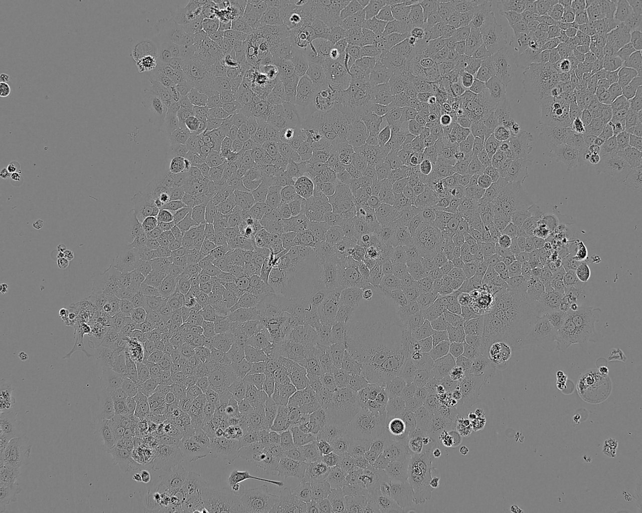 LK-2 Thawing人肺癌細胞系,LK-2 Thawing