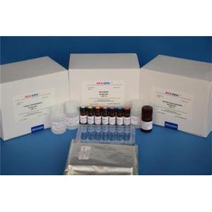 人CX3C趋化因子受体1(CX3CR1)ELISA试剂盒,Human CX3C-chemokine receptor 1, CX3CR1 Elisa Kit