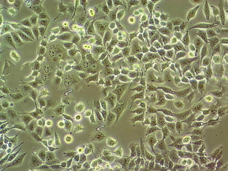 NCI-H1836 cell line人小细胞肺癌细胞系,NCI-H1836 cell line