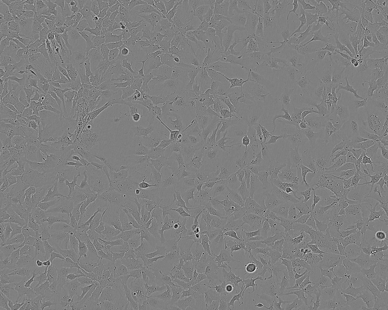 OUMS-23 Thawing人结肠癌细胞系,OUMS-23 Thawing