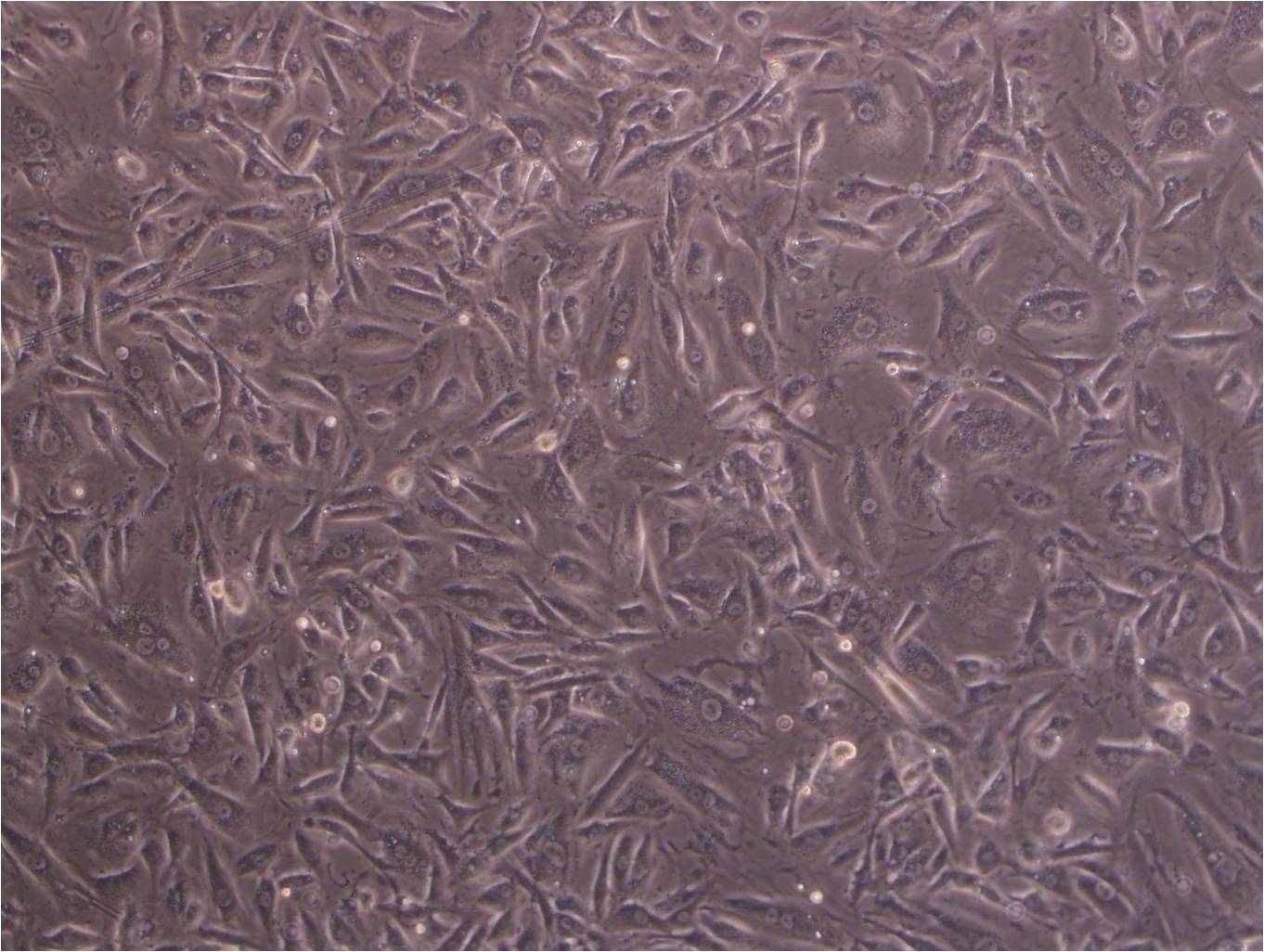 DBTRG-05MG cell line人脑胶质母细胞瘤细胞系,DBTRG-05MG cell line