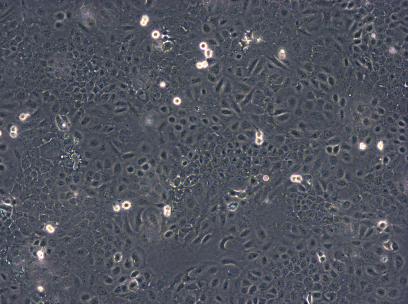 MFE-280 cell line子宫内膜癌细胞系,MFE-280 cell line