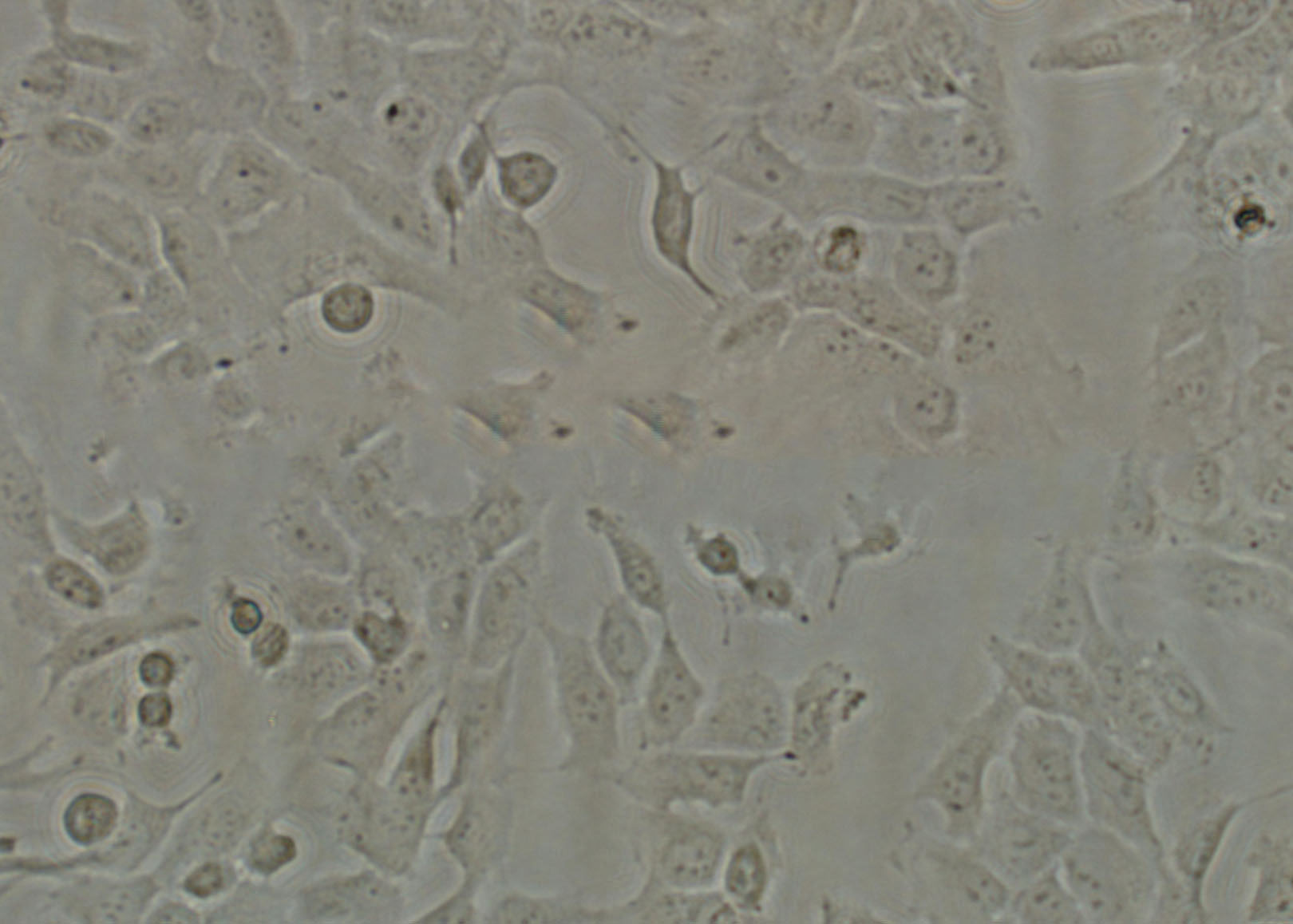 HTh74 cell line人未分化甲状腺癌细胞系,HTh74 cell line