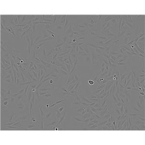 Mel-RM cell line人黑色素瘤细胞系