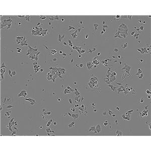 SHIN-3 cell line人卵巢浆液性囊腺癌细胞系,SHIN-3 cell line