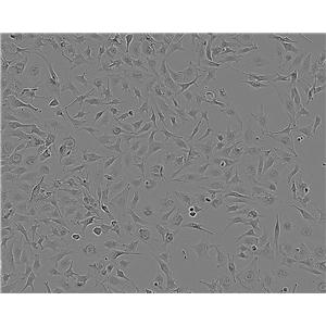 RIN-14B cell line大鼠胰岛素瘤细胞系