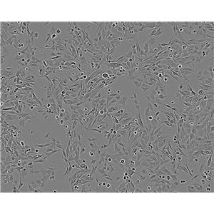 SUM102PT cell line人乳腺癌细胞系,SUM102PT cell line