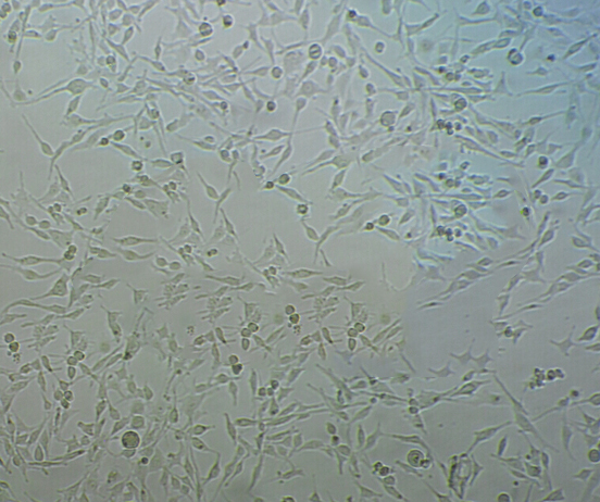 108CC15 cell line小鼠神经母瘤与大鼠胶质瘤之融合细胞系,108CC15 cell line