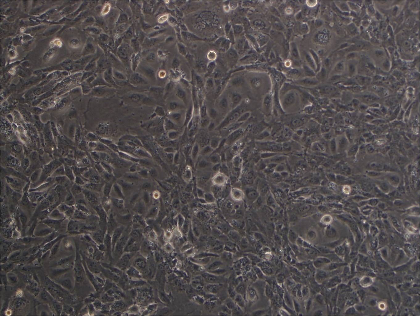 HCC4006 cell line人肺癌腺癌细胞系,HCC4006 cell line