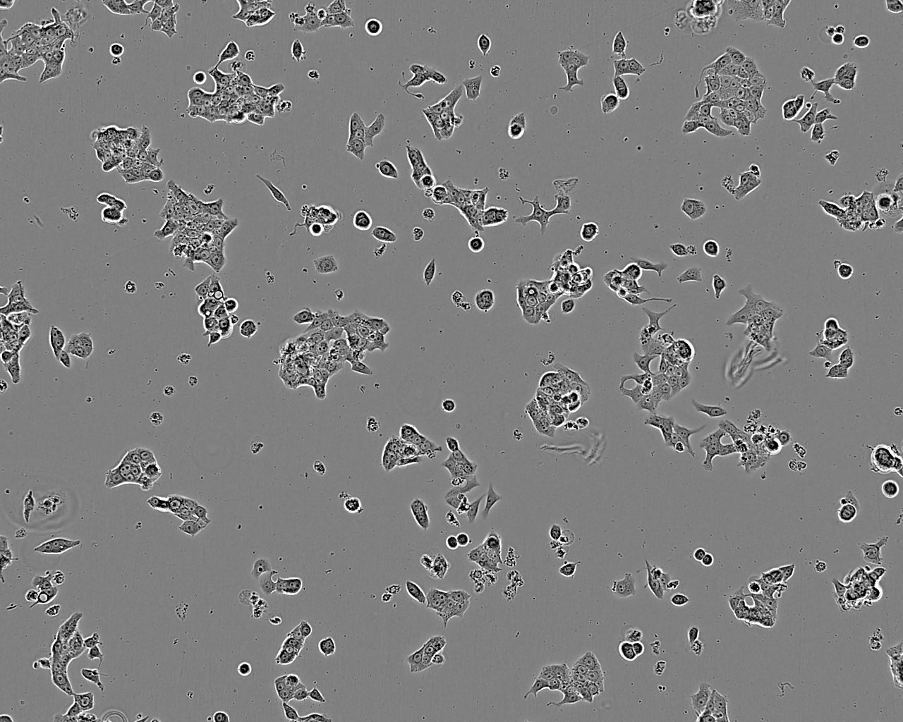 OVCA432 cell line人卵巢癌细胞系,OVCA432 cell line