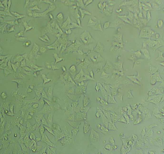 EFM-192B cell line人乳腺癌细胞系,EFM-192B cell line