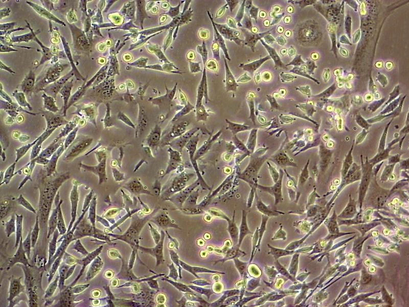 SUSM-1 cell line人肺成纤维细胞系,SUSM-1 cell line