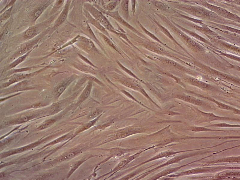 HPAF cell line人肺动脉成纤维细胞系,HPAF cell line