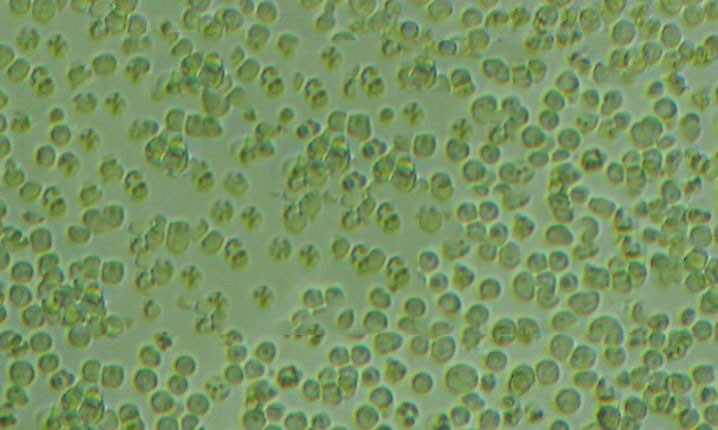 HH [Human lymphoma] cell line人皮肤T淋巴细胞瘤细胞系,HH [Human lymphoma] cell line