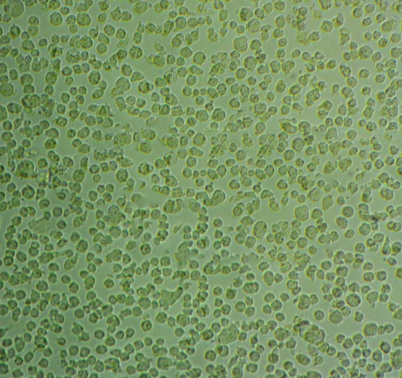 Granta-519 cell line人类B细胞淋巴癌细胞系,Granta-519 cell line
