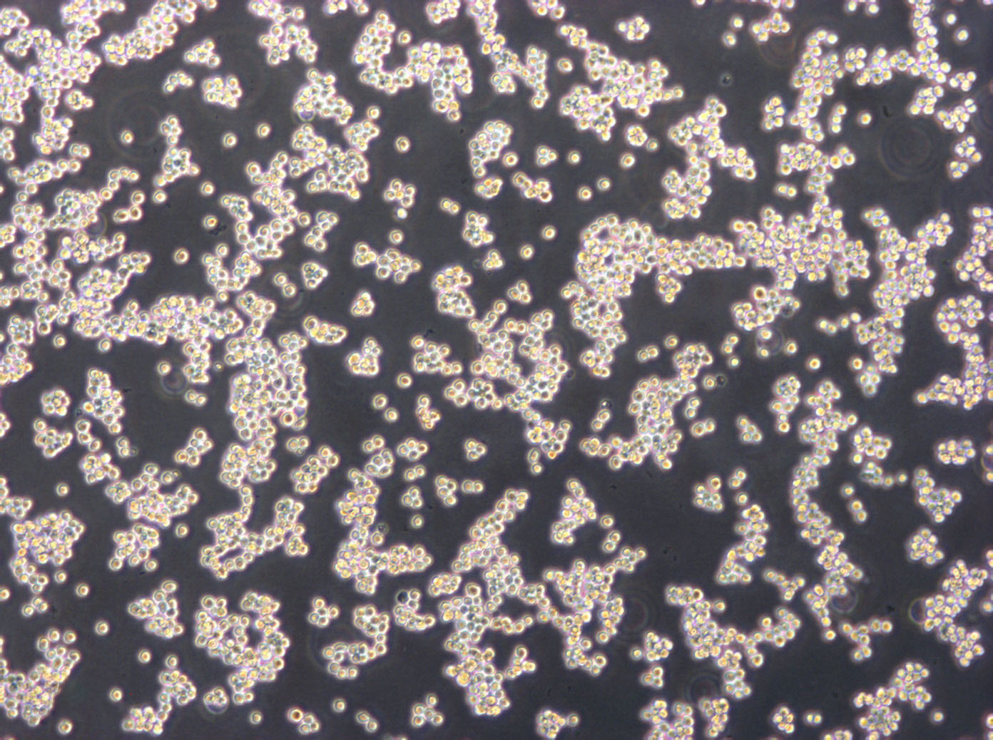 OCI-Ly19 cell line人弥漫大B淋巴瘤细胞系,OCI-Ly19 cell line