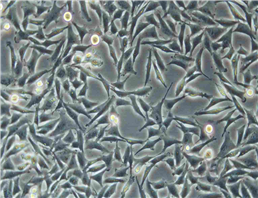 HEC-151 cell line人子宫内膜癌细胞系