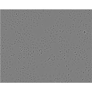 SW780 cell line人膀胱移行癌细胞系