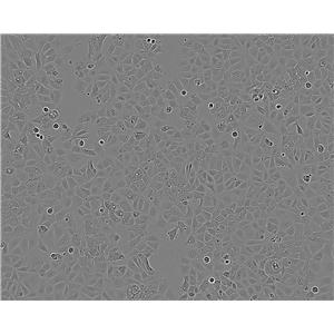 hTERT-HME1 cell line人黑色素瘤细胞系