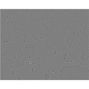 SW1271 cell line人肺腺癌细胞系