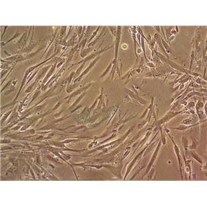 MOVAS-1 cell line小鼠主动脉平滑肌细胞系