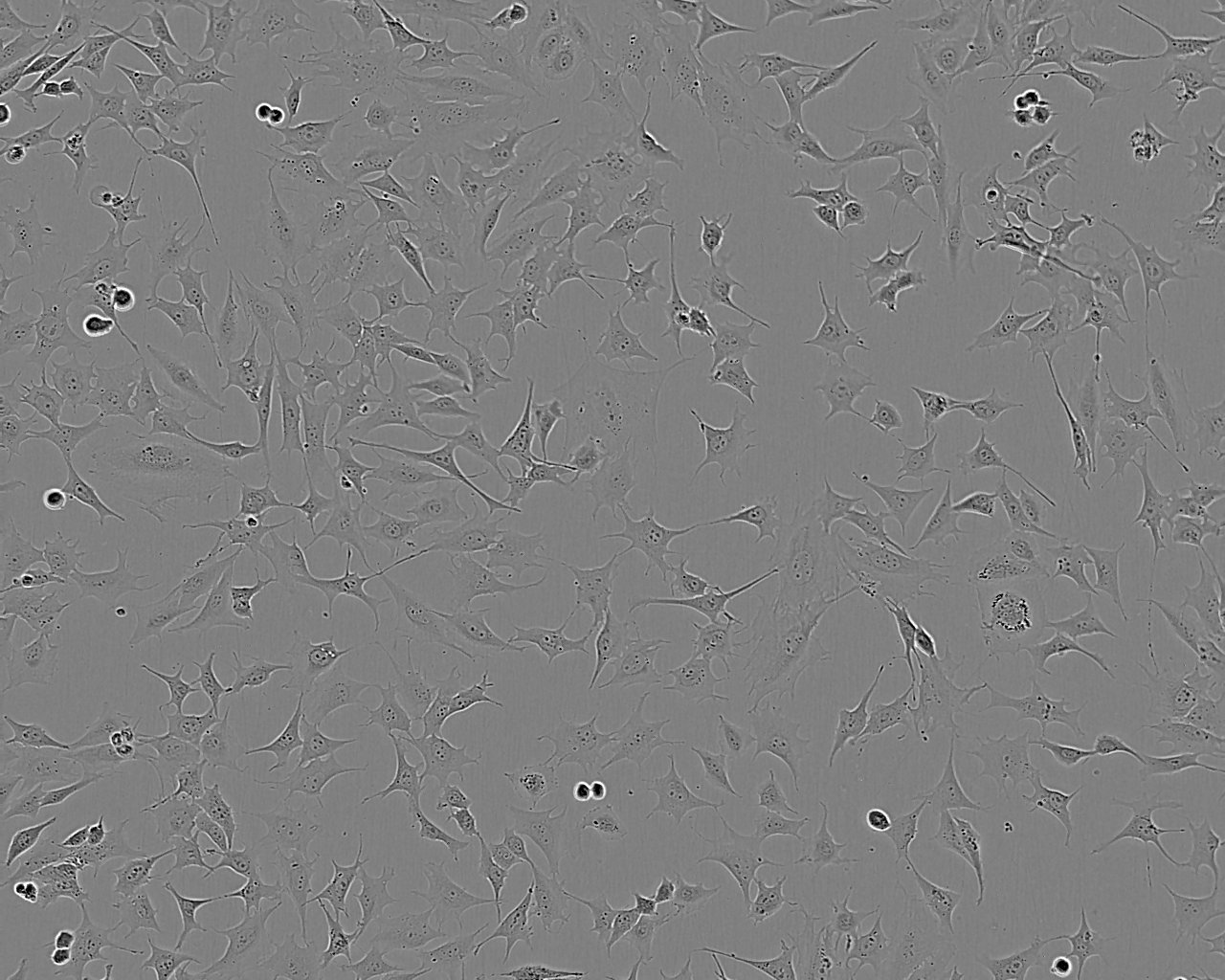 U-118 MG 人脑星形胶质母细胞瘤细胞系,U-118 MG