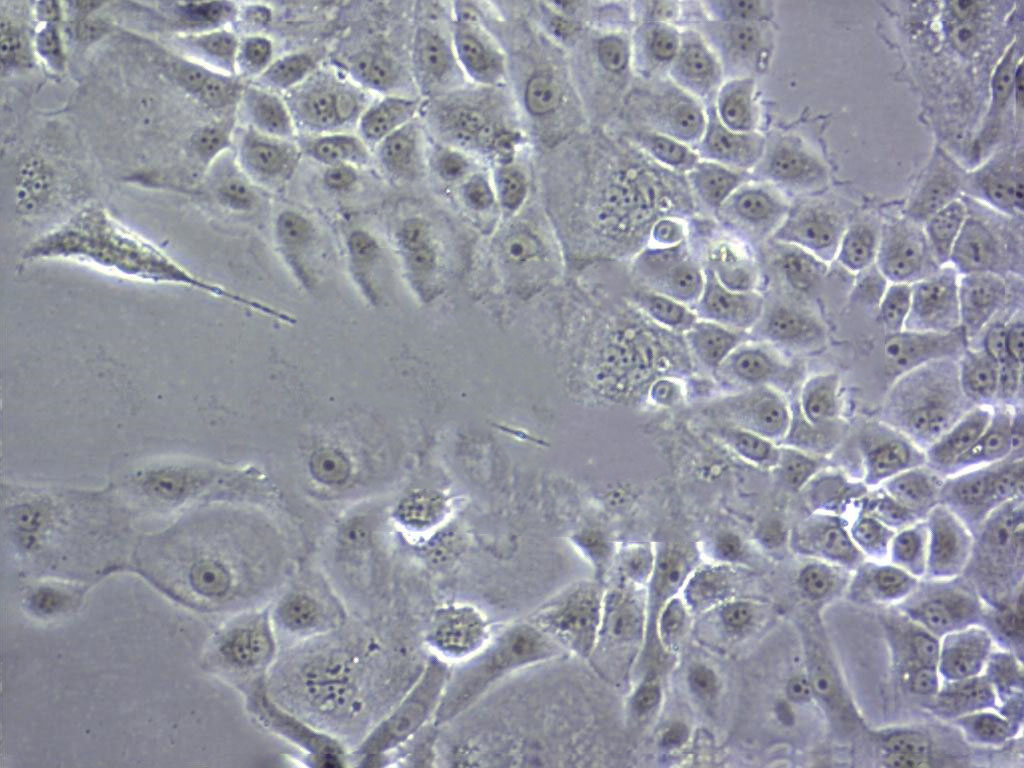 SK-UT-1 人子宫内膜癌细胞系,SK-UT-1