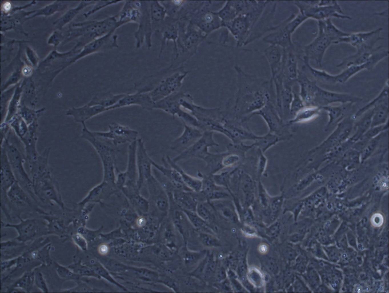 HuH-1 cell line人肝癌细胞系,HuH-1 cell line