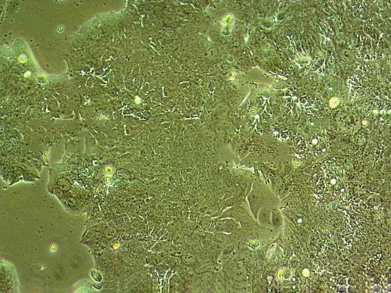 TE-10 人食管癌細胞系,TE-10