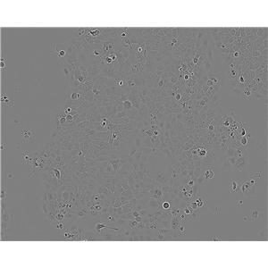RLE-6TN 大鼠肺泡Ⅱ型细胞系