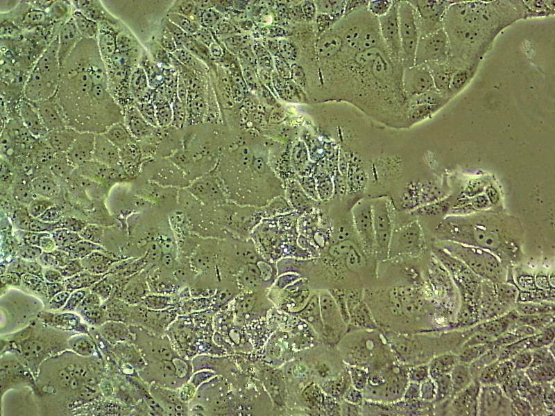 FO [Mouse myeloma] 小鼠骨髓瘤细胞系,FO [Mouse myeloma