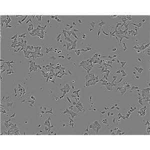 HSC-5 [Human skin squamous cell carcinoma] 人皮肤鳞癌细胞系