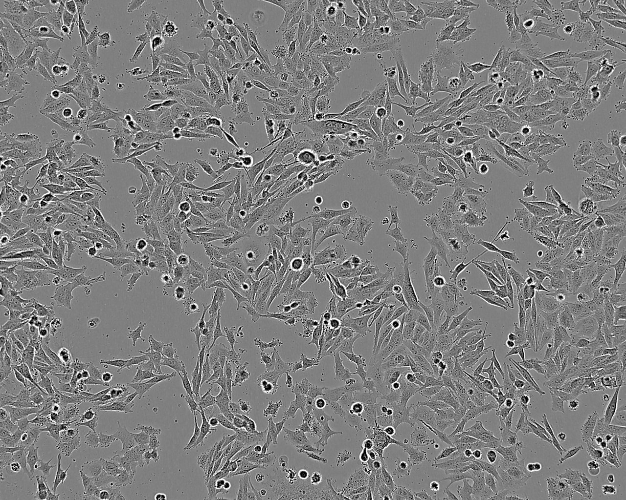 NCI-H740 人肺癌細(xì)胞系,NCI-H740