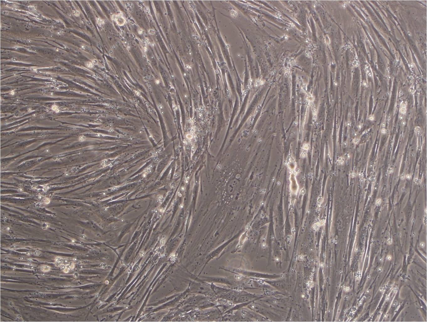 SK-LMS-1 人阴户平滑肌肉瘤细胞系,SK-LMS-1
