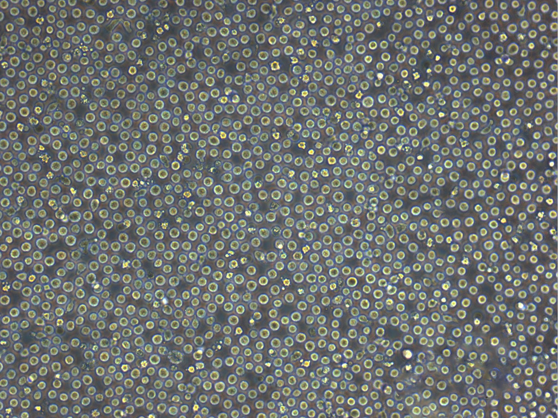 UT-7 人类原巨核细胞型白血病细胞系,UT-7