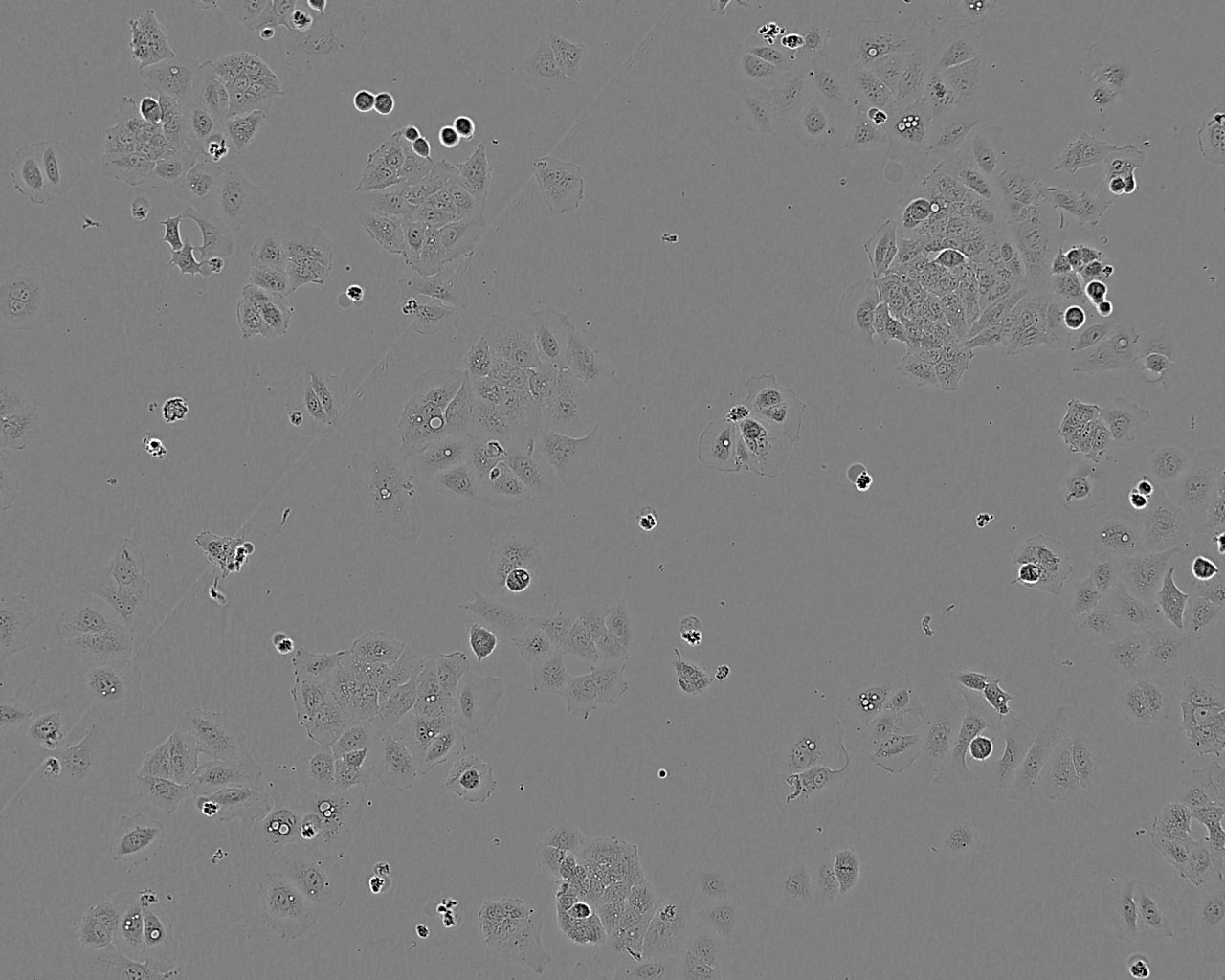 A2780细胞：人卵巢癌细胞系,A2780