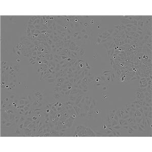 PLA-801D细胞：人高转移肺癌细胞系