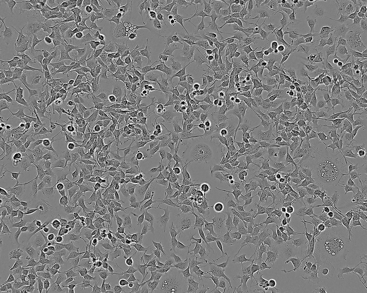 PANC-1细胞：人胰腺癌细胞系,PANC-1