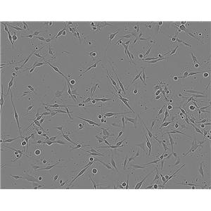 GP2-293细胞：人胚肾上皮包装细胞系
